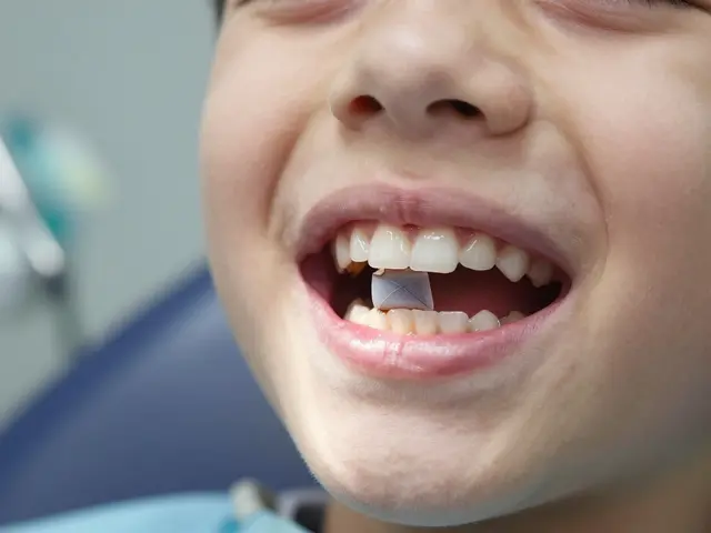 Co na špatnou sklovinu? Vše, co potřebujete vědět o skloionomerních plombách