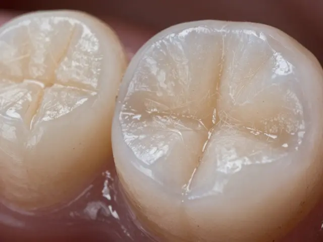 Jak zjistit otisky prstů u kompozitních restaurací zubů