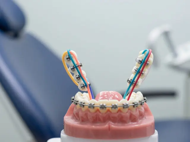 Na co jsou gumičky na rovnátka? Vše, co potřebujete vědět o jejich funkci a důležitosti