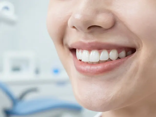 Bílá dieta po bělení zubů: Co jíst a čemu se vyhnout