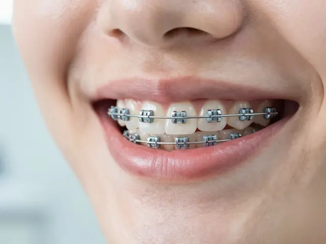 Keramické rovnátka: Konec mýtů a pravda o neviditelném narovnávání